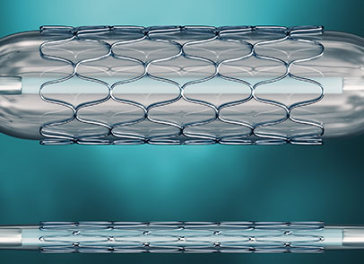 Stent, medizinisches Implantat